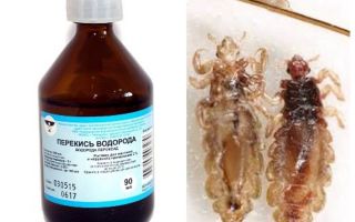 Peróxido de hidrogênio de piolhos e lêndeas