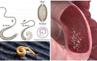 Como remover pinworms em adultos e crianças