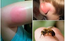 Bumblebee mordido - o que fazer em casa