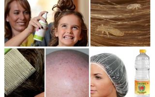 Pediculose de combate em criança e adulto