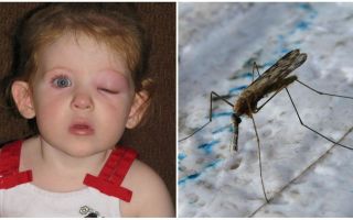 O que fazer se uma criança tiver um olho inchado depois de uma picada de mosquito