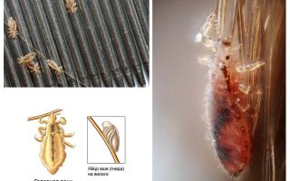 Período de incubação de piolhos e lêndeas em humanos