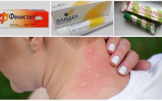 Como manchar picadas de mosquito