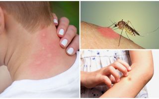 Por que o mosquito morde coceira