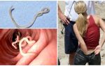 O ciclo de desenvolvimento de pinworms