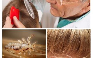 Prevenção da pediculose na escola