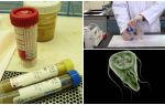 Como passar corretamente fezes em Giardia, métodos de análise