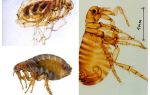 Pulgas humanas: como olhar e como se livrar