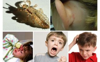 O que é pediculose perigosa