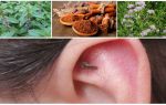 Como escapar de remédios populares mosquitos