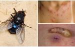 Uma mosca que põe larvas sob a pele humana