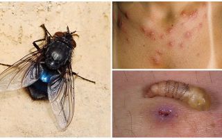 Uma mosca que põe larvas sob a pele humana