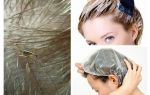 Piolhos morrerão se você tingir seu cabelo