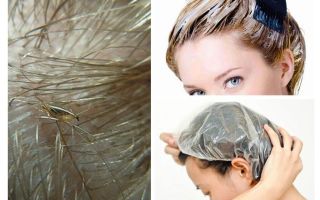 Piolhos morrerão se você tingir seu cabelo