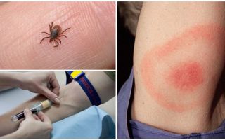 Exame de sangue para borreliose