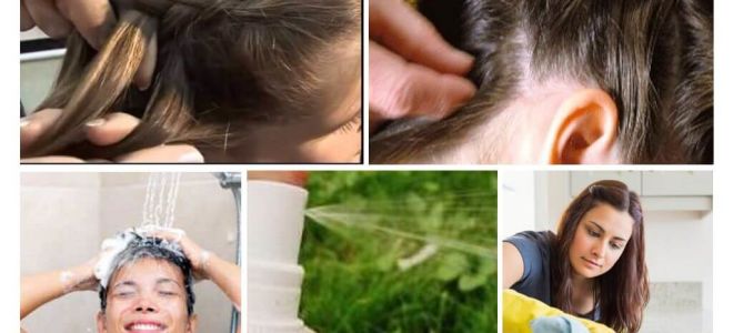 Meios para prevenir piolhos em crianças