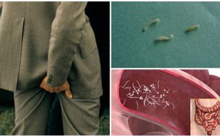 Tratamento de remédios populares pinworms