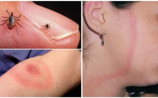 Sintomas, efeitos e prevenção de borreliose transmitidos por carrapatos em adultos
