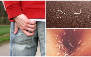 As melhores drogas para o tratamento de pinworms