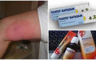 O que fazer se depois de uma perna de picada de mosquito inchada