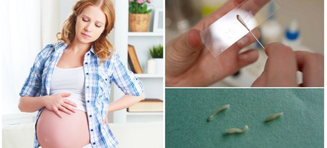 Como tratar pinworms em mulheres grávidas