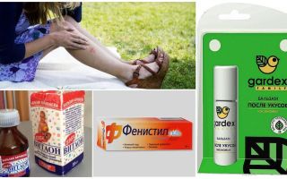 O que fazer para picadas de mosquito não coçar