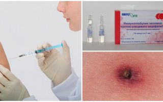 Imunoglobulina contra encefalite transmitida por carrapatos