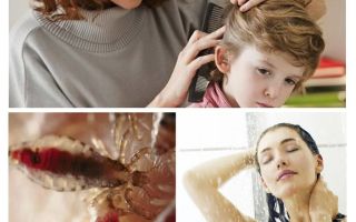 Prevenção de pediculose e tifo