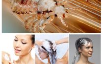 Shampoos de pediculose para crianças e adultos