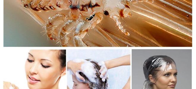 Shampoos de pediculose para crianças e adultos