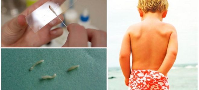 Como fazer raspagem em ovos pinworm