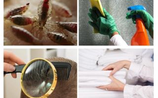Novo sanpin para a prevenção da pediculose