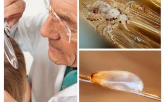 Exame do paciente para pediculose no departamento