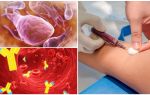 Exame de sangue para lamblia: o que, como e onde passar, custo e decodificação