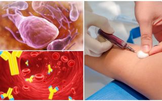 Exame de sangue para lamblia: o que, como e onde passar, custo e decodificação