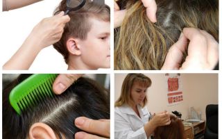 Pediculose na escola - para onde ir e o que fazer