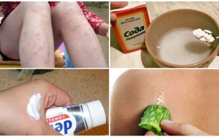Como remover manchas vermelhas de picadas de mosquito