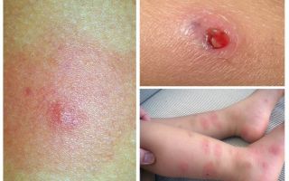 Quais são as baratas perigosas para os seres humanos?