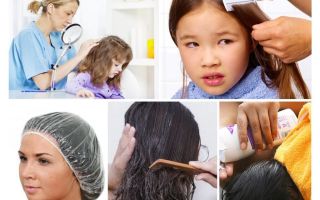 Algoritmo de tratamento do paciente para pediculose