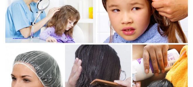 Algoritmo de tratamento do paciente para pediculose