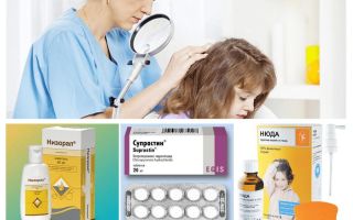 Por que a cabeça coça se não houver piolhos?