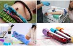 Exames de sangue após uma picada de carrapato