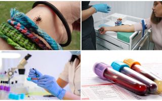 Exames de sangue após uma picada de carrapato