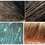 Piolhos no cabelo