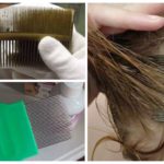 Pentear piolhos e lêndeas