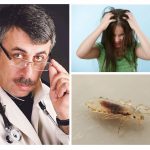 Komarovsky sobre pediculose