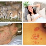 Doenças derivadas de camundongos