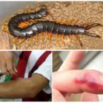 Perigo da mordida de Scolopendra