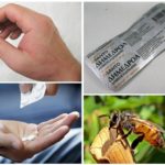 Mordida alergia tratamento