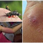Os efeitos de uma picada de mordida
